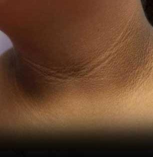 चेहरा गोरा पण मान काळवंडलीये? ७ टिप्स, मानेचे काळे थर दूर होतील-सुंदर दिसेल मान