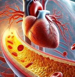 स्वयंपाकासाठी 'हे' तेल वापरा; बॅड कोलेस्टेरॉल कमी करायचं तर आहारात तेलाचं योग्य प्रमाण महत्वाचं..