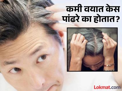 Hair Care Tips : Dermatologist tells causes of white hair and how to prevent grey hair | डर्मेटोलॉजिस्टने सांगितलं कमी वयात केस पांढरे होण्याची कारणे, सोबतच सांगितलं काही उपाय...