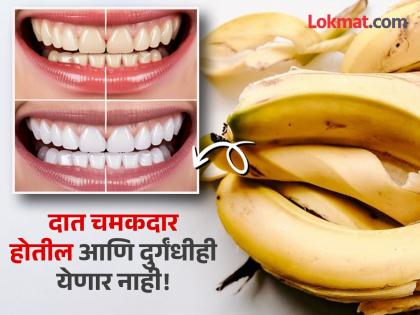 Banana peel for white teeth, yellow teeth home remedies | दातांवर जमा पिवळा थर झटक्यात होईल दूर, केळीच्या सालीच 'असा' करा वापर!