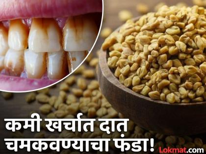 Ayurvedic doctor told easy and effective home remedies for teeth whitening | दात चमकवण्यासाठी आयुर्वेद डॉक्टरांनी सांगितले उपाय, फक्त ५ रूपयात दूर होईल पिवळेपणा!