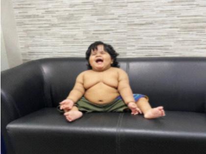 MUMBAI: Ibrahim came down from kilos to grams after the surgery, the monthly weight gain stopped | Mumbai: इब्राहिम शस्त्रक्रियेनंतर किलोवरून आला ग्रॅमवर, महिन्याला होणारी वजनवाढ थांबली