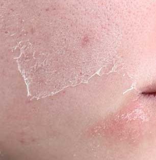 ६ घरगुती पदार्थ चेहऱ्यावर आणतात आठवडाभरात तेज, थंडीत त्वचाही राहते मऊमुलायम! कशाला आणता महागड्या क्रिम्स...