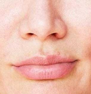 हिवाळ्यात ओठांजवळ काळवंडते? त्वचा ताणली जाऊन झोंबते? पाहा काय करायचे, वेळीच उपाय करा कारण .....