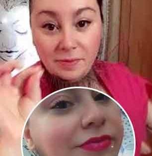 महिलेनं वाढवली पुरुषांसारखी लांब दाढी, आवड म्हणून नाही एका आजाराचा गंभीर परिणाम