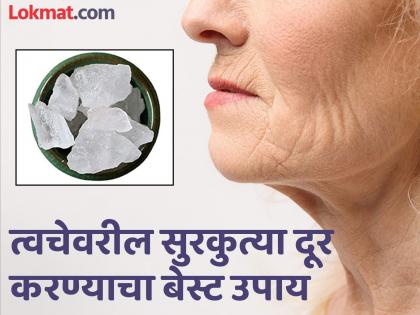 How to use fitkari or alum for better skin | त्वचेवरील पुरळ आणि सुरकुत्या दूर करायच्यात? तुरटीचा असा करा वापर, मग बघा कमाल...