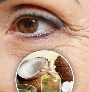 कमी वयात आलेल्या सुरकुत्या खोबऱ्याचं तेल करेल दूर, पण माहीत असली पाहिजे वापरण्याची योग्य पद्धत