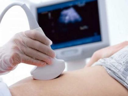 pregnant women in rural areas of yavatmal not getting facilities sonography under government matritva yojana | सोनोग्राफी सेंटरवर ‘मातृत्ववंदन’ला हरताळ, पैशासाठी गर्भवतींची अडवणूक