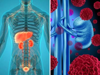 Nuclear medicine in the cold for five years; How heart, kidney, cancer patients will benefit! | पाच वर्षांपासून न्यूक्लिअर मेडिसीन थंडबस्त्यात; हृदय, किडनी, कर्करोगाच्या रुग्णांना कसा मिळणार लाभ!