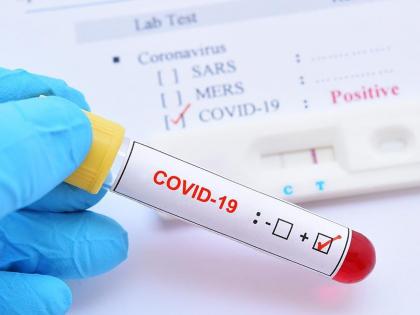 CoronaVirus Marathi news 115 new patients in Thane district today; one died hrb | CoronaVirus in Thane धोक्याची घंटा! ठाणे जिल्ह्यात आज सर्वाधिक नवे रुग्ण; एकाचा मृत्यू 