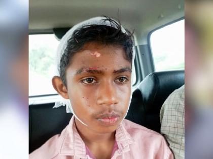 A school boy injured in a collision with an unknown four-wheeler | अज्ञात चारचाकी वाहनाच्या धडकेत शाळकरी बालक जखमी