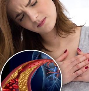 Heart Attack चा धोका वाढवणारं हाय कोलेस्टेरॉल कमी करतात 'ही' पिवळी फळं, रोज खा मजेत राहा