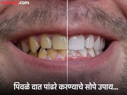 Teeth whitening tips 4 home made ayurvedic manjan | दातांचा पिवळेपणा घालवणारे ४ आयुर्वेदिक उपाय, एकदा करून बघाच...