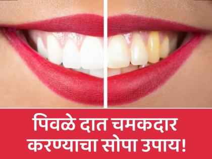 Know the benefits of salt and mustard oil for yellow teeth | मोहरीचं तेल आणि मिठाचा वापर करून पिवळे दात करा चमकदार, जाणून घ्या कसा कराल वापर!