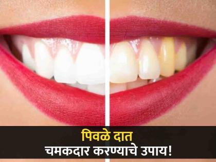 How to Get Rid of Yellow Teeth | पिवळे दात चमकदार करण्याचे बेस्ट घरगुती उपाय, एकदा करून बघाच!