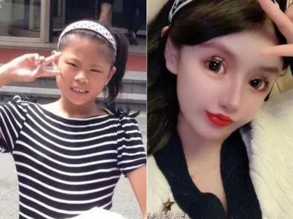 girl obsessed with plastic surgery 100 procedures till now story shocked people | बापरे! सुंदर दिसण्याची भलतीच हौस; 100 प्लास्टिक सर्जरी, खर्च केले तब्बल 4.66 कोटी