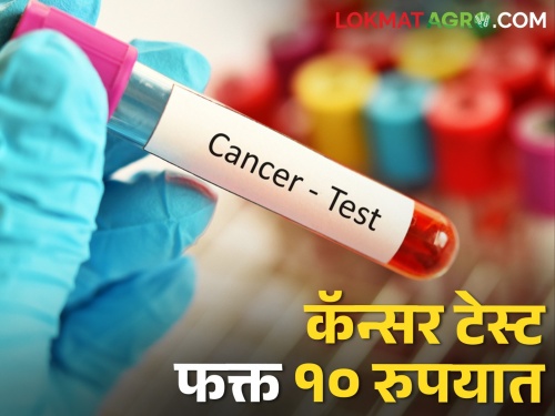 Farmers don't be afraid.. Cancer test is done for only this much rupees | शेतकऱ्यांनो घाबरू नका.. कॅन्सर आहे की नाही याची टेस्ट होतेय फक्त इतक्या रुपयात