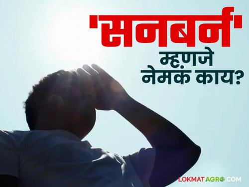 Does your skin burn in ten minutes? Know what 'sunburn' really means | दहा मिनिटांत कातडी भाजतेय? जाणून घ्या 'सनबर्न' म्हणजे नेमकं काय