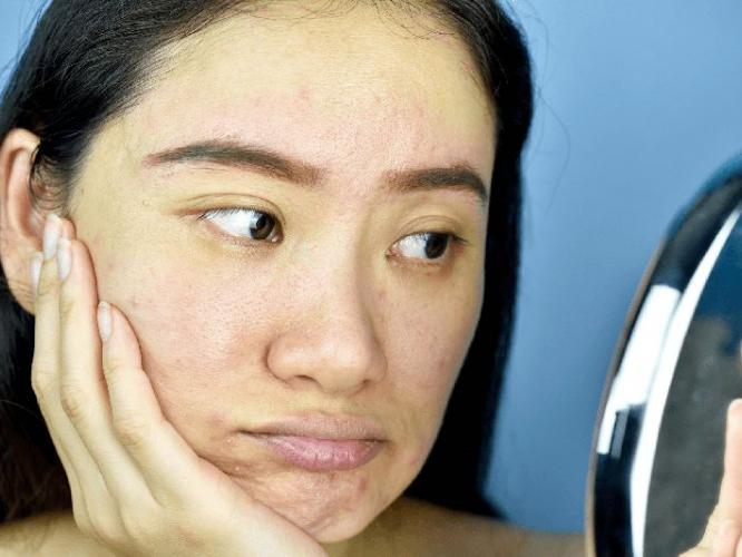 मसूर डाळीचा फेस पॅक! 'या' पद्धतीने लावा, डेडस्किन- टॅनिंग होईल दूर, मिळेल पार्लरसारखा इंस्टंट ग्लो..