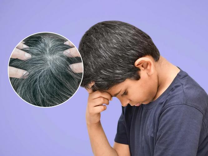 पांढऱ्या केसांमुळे ऐन तारुण्यात आण्टी दिसता? रामदेवबाबा सांगतात, केस काळे करण्याचा नैसर्गिक उपाय