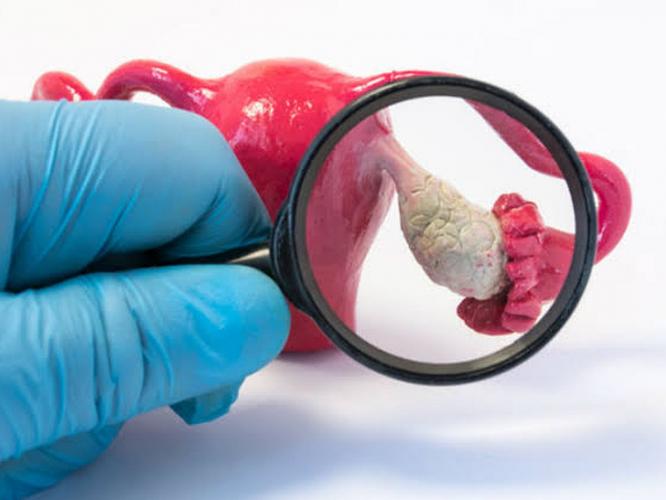 तरुणींमध्ये PCOS चा त्रास वाढण्याची ५ मुख्यं कारणं- वेळीच 'हे' बदल करा, त्रास कमी होईल तरुणींमध्ये PCOS चा त्रास वाढण्याची ५ मुख्यं कारणं- वेळीच 'हे' बदल करा, त्रास कमी होईल