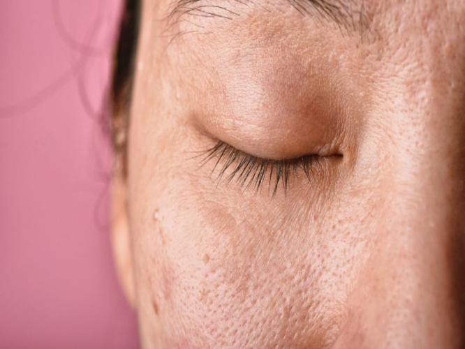 थंडी म्हणजे खरखरीत त्वचा ! त्वचा हायड्रेटेड ठेवण्यासाठी एकदम सोपा उपाय, पाहा त्वचेचे तेज कसे वाढेल