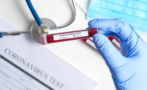 Corona virus : 1751 new corona patients were added In Pune city on Wednesday,, the total number of corona patients was 42 thousand 466 | Corona virus : पुणे शहरात बुधवारी १७५१ रुग्णांची भर, कोरोनाबधितांची संख्या ४२ हजार ४६६ वर Corona virus : 1751 new corona patients were added In Pune city on Wednesday,, the total number of corona patients was 42 thousand 466 | Corona virus : पुणे शहरात बुधवारी १७५१ रुग्णांची भर, कोरोनाबधितांची संख्या ४२ हजार ४६६ वर