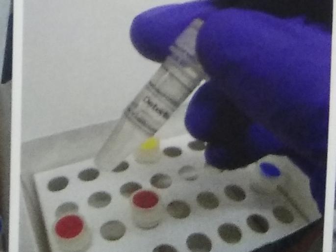 Corona inspections in Kolhapur by an unrecognized kit | धक्कादायक : मान्यताप्राप्त नसलेल्या किटद्वारे कोल्हापूरात कोरोना तपासण्या Corona inspections in Kolhapur by an unrecognized kit | धक्कादायक : मान्यताप्राप्त नसलेल्या किटद्वारे कोल्हापूरात कोरोना तपासण्या