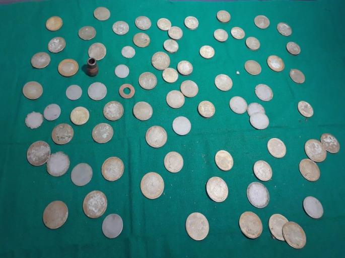 Abub, 72 pounds from psychoanalysis! | अबब, मनोरुग्णाच्या पोटातून काढली तब्बल ७२ नाणी ! Abub, 72 pounds from psychoanalysis! | अबब, मनोरुग्णाच्या पोटातून काढली तब्बल ७२ नाणी !