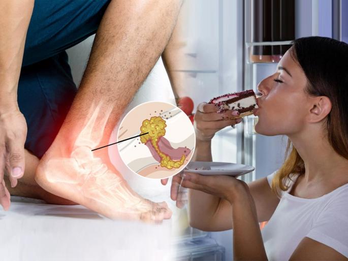 How to Reduce Uric Acid Naturally Uric acid Causes, Treatment, Diet : Is uric acid increasing? Don't take 4 things in your diet, your health will be poor | युरीक ॲसिड सारखं वाढतंय? आहारात अजिबात घेऊ नका ४ गोष्टी, तब्येत राहील ठणठणीत