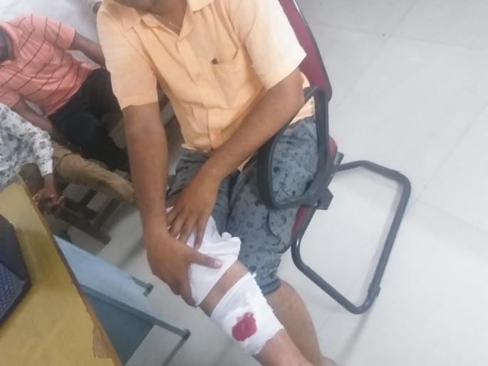 KESURDD FIGHT: Spray attack and build up business with three people | केसुर्डीत मारामारी : स्प्रे हल्ला करुन बांधकाम व्यावसायासह तिघांना मारहाण KESURDD FIGHT: Spray attack and build up business with three people | केसुर्डीत मारामारी : स्प्रे हल्ला करुन बांधकाम व्यावसायासह तिघांना मारहाण