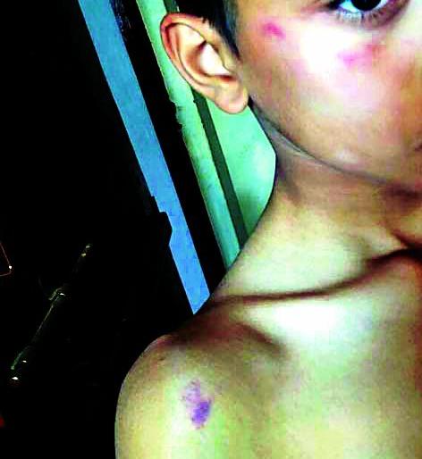 Sixth student beaten by teacher | सहावीच्या विद्यार्थ्याला शिक्षकाकडून मारहाण Sixth student beaten by teacher | सहावीच्या विद्यार्थ्याला शिक्षकाकडून मारहाण