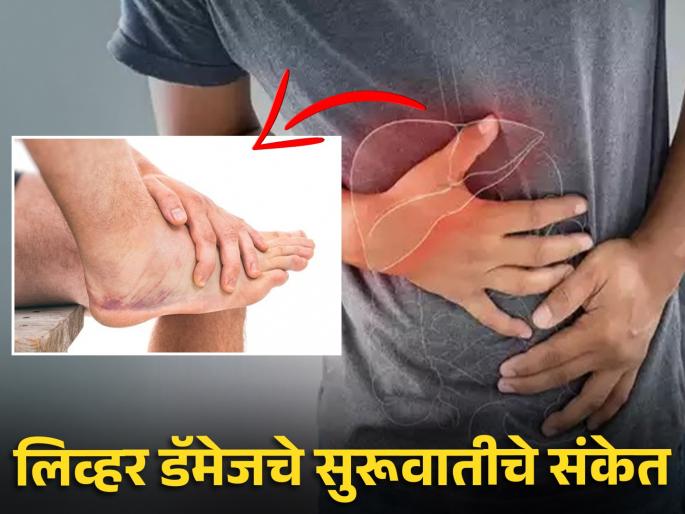 Dont ignore these early symptom of liver damage | 'हे' संकेत दिलू लागले तर समजा खराब होत आहे तुमचं लिव्हर, दुर्लक्ष करा तर जाऊ शकतो जीव! Dont ignore these early symptom of liver damage | 'हे' संकेत दिलू लागले तर समजा खराब होत आहे तुमचं लिव्हर, दुर्लक्ष करा तर जाऊ शकतो जीव!