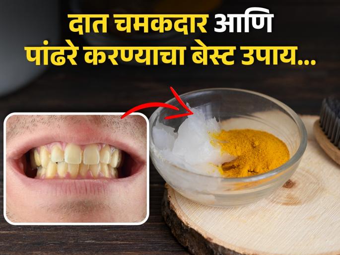 How to use coconut oil and turmeric for teeth whitening | दातांचा पिवळेपणा दूर करण्यासाठी हळद आणि खोबऱ्याच्या तेलाचा 'असा' करा वापर... How to use coconut oil and turmeric for teeth whitening | दातांचा पिवळेपणा दूर करण्यासाठी हळद आणि खोबऱ्याच्या तेलाचा 'असा' करा वापर...