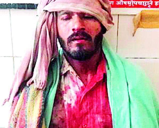 One-and-a-half hour life-time game | दीड तास चालला जीवन-मरणाचा खेळ One-and-a-half hour life-time game | दीड तास चालला जीवन-मरणाचा खेळ