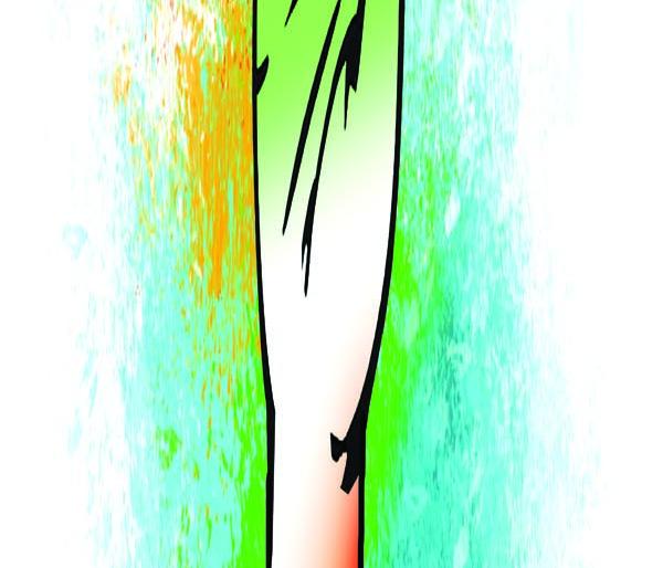 Why the Congress sore? | काँग्रेसचा घसा का बसलाय?