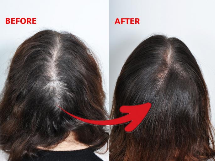Hair Care Tips: Hair long, beauty; Pay attention to 5 things, hair will grow twice as fast | Hair Care Tips : लांबसडक केस हवेत तर फक्त ५ गोष्टी करा, केस वाढतील दुप्पट वेगाने-दिसतील सुंदर