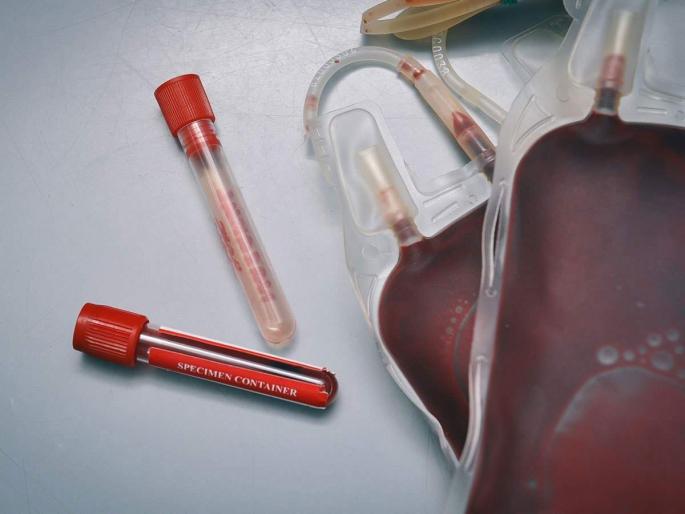 Still waiting for plasma collection at district hospital! | जिल्हा रुग्णालयातील प्लाझ्मा संकलनास अद्यापही प्रतीक्षा ! Still waiting for plasma collection at district hospital! | जिल्हा रुग्णालयातील प्लाझ्मा संकलनास अद्यापही प्रतीक्षा !