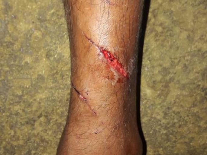 Leopard leaped on two-wheeler | बिबट्याने घेतली दुचाकीस्वारावर झेप Leopard leaped on two-wheeler | बिबट्याने घेतली दुचाकीस्वारावर झेप