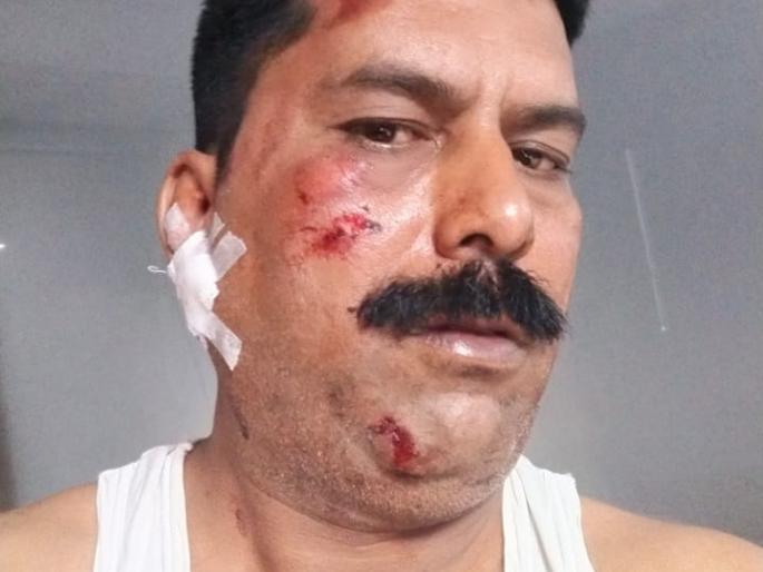 Chaighe injured in Kajgaon doctor's car accident | कजगाव येथील डाॅक्टरांच्या गाडीला अपघात, चाैघे जखमी Chaighe injured in Kajgaon doctor's car accident | कजगाव येथील डाॅक्टरांच्या गाडीला अपघात, चाैघे जखमी