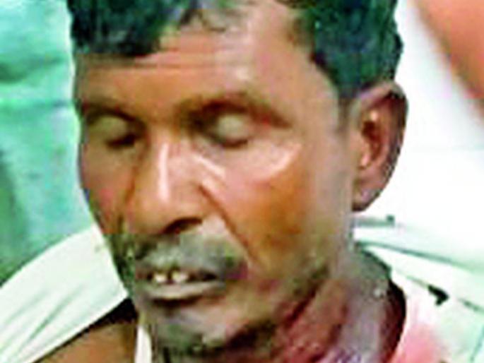 Tigers attacked in Hizrat | हिवरात भरदुपारी वाघाचा हल्ला Tigers attacked in Hizrat | हिवरात भरदुपारी वाघाचा हल्ला