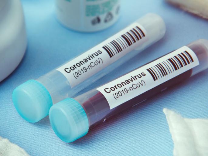 Coronavirus: India will soon have one lakh corona tests per day | Coronavirus: भारतात लवकरच दररोज एक लाख कोरोना टेस्ट होणार Coronavirus: India will soon have one lakh corona tests per day | Coronavirus: भारतात लवकरच दररोज एक लाख कोरोना टेस्ट होणार