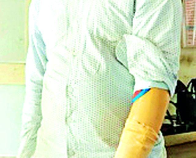 Divyang Student deprived of demonstration exam | दिव्यांग विद्यार्थी प्रात्यक्षिक परीक्षेपासून वंचित Divyang Student deprived of demonstration exam | दिव्यांग विद्यार्थी प्रात्यक्षिक परीक्षेपासून वंचित