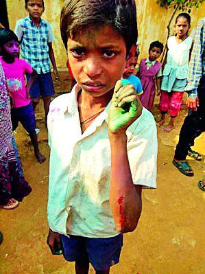 Tea thrown on student's body | विद्यार्थ्याच्या अंगावर फेकला चहा