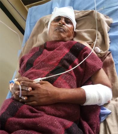 Injured attackers injured | अस्वलाच्या हल्ल्यात भाविक जबर जखमी