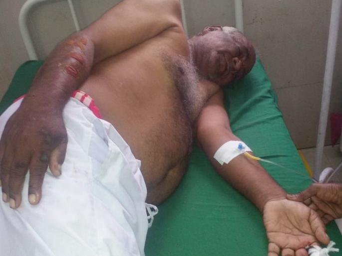 Farmers injured in leopard attack | बिबट्याच्या हल्लयात शेतकरी जखमी Farmers injured in leopard attack | बिबट्याच्या हल्लयात शेतकरी जखमी