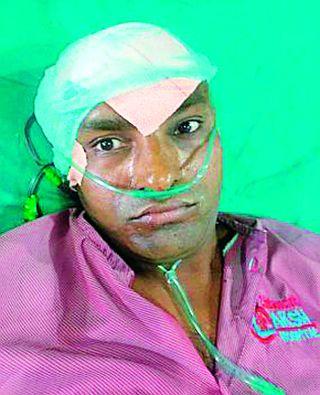 Successful endocrine surgery | अथक प्रयत्नाअंती मेंदूवर यशस्वी शस्त्रक्रिया