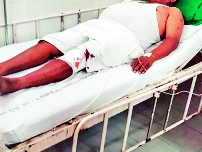 Former Congress district president Nandu Nagarkar attacked | काँग्रेसचे माजी शहर जिल्हाध्यक्ष नंदू नागरकर यांच्यावर प्राणघातक हल्ला Former Congress district president Nandu Nagarkar attacked | काँग्रेसचे माजी शहर जिल्हाध्यक्ष नंदू नागरकर यांच्यावर प्राणघातक हल्ला