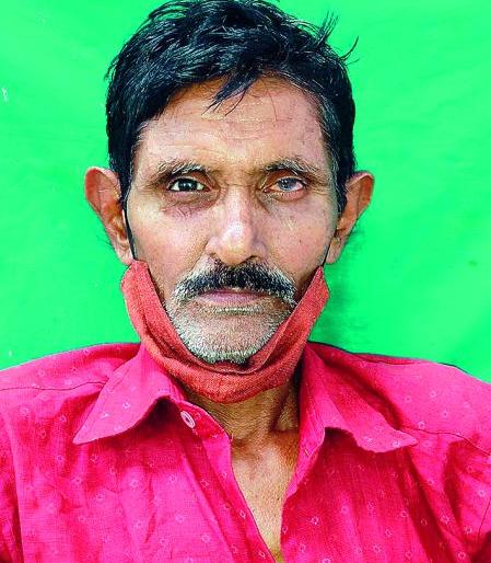 Doctors found a third eye for those who lost their eyes | डोळे गमावलेल्यांसाठी डॉक्टरांनी शोधला तिसरा डोळा Doctors found a third eye for those who lost their eyes | डोळे गमावलेल्यांसाठी डॉक्टरांनी शोधला तिसरा डोळा