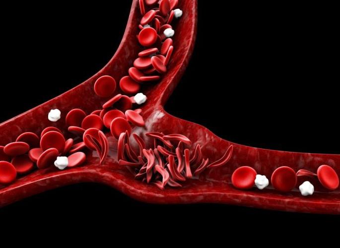 Sickle cell awareness week; To check, fill four thousand! | सिकलसेल जनजागृती आठवडा; तपासणी करायचीय, भरा चार हजार!